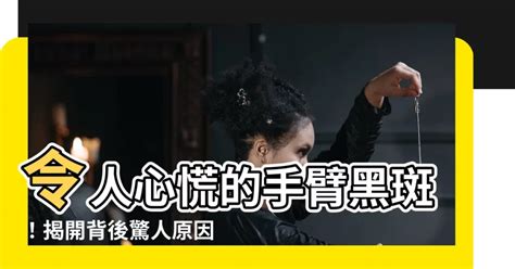 手臂長黑斑